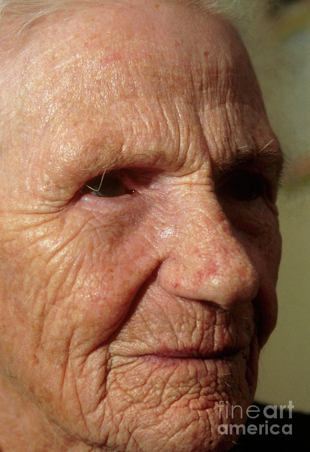 Close-up Of The Face Of An Elderly Woman Photograph by Conor Caffrey/science Photo Library