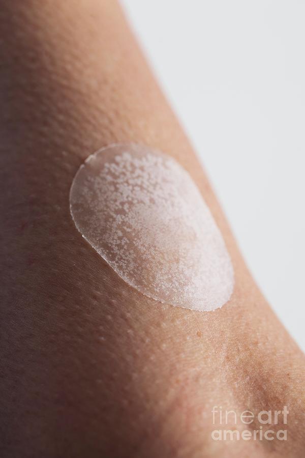 Close-up Of Upper Arm With Hormone Replacement Patch Photograph by Cristina Pedrazzini/science Photo Library