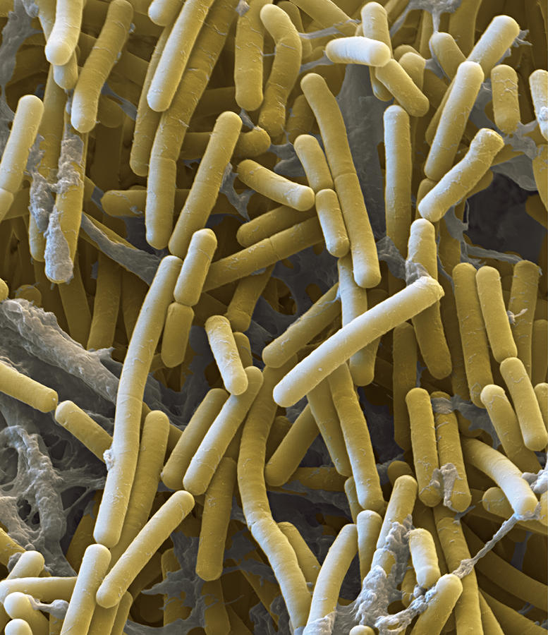 Clostridium Botulinum, Sem Photograph by Meckes/ottawa