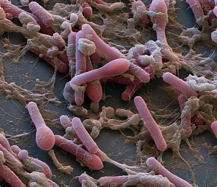 Clostridium Botulinum, Sem Photograph by Oliver Meckes EYE OF SCIENCE