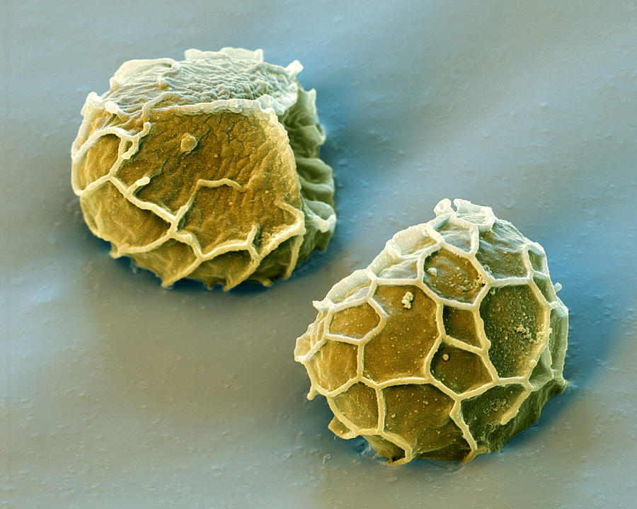 Clubmoss Spores Lycopodium Annotinum Photograph by Meckes/ottawa