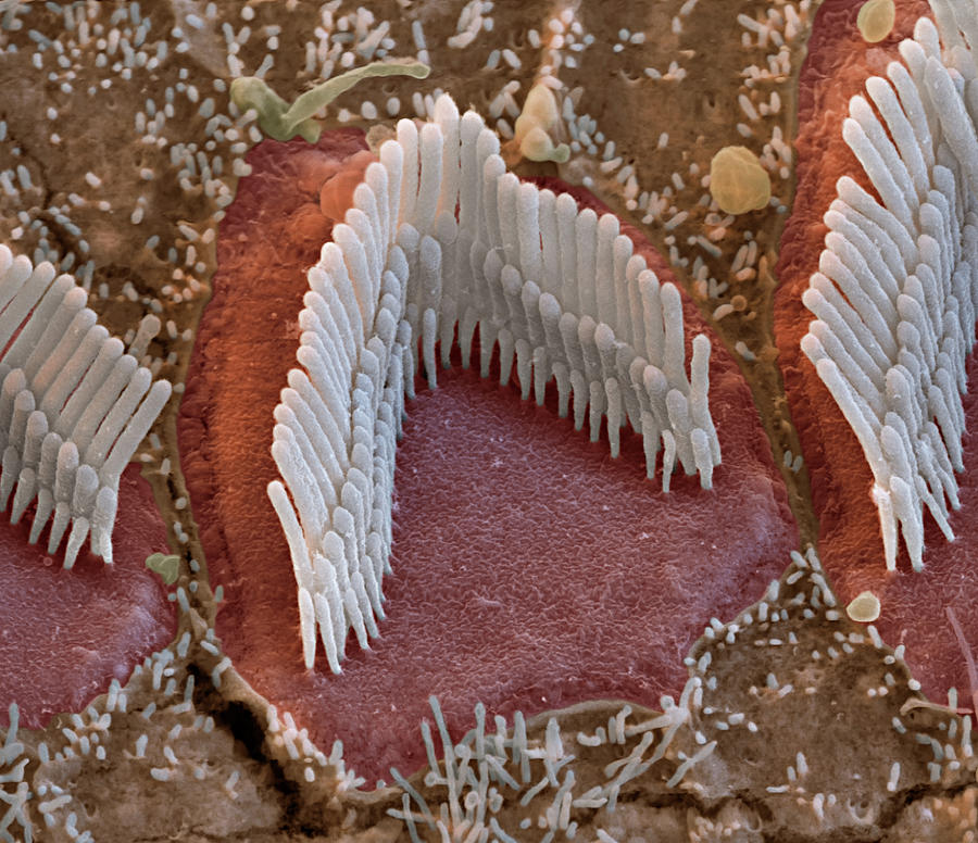 Cochlea, Outer Hair Cell, Sem Photograph by Oliver Meckes EYE OF SCIENCE