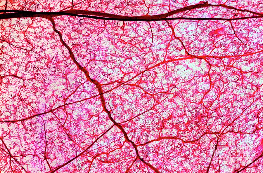 Colon Blood Vessels Photograph by Dr Keith Wheeler/science Photo Library