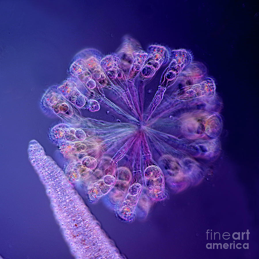 Colonial Rotifers And Hydra Tentacle Photograph by Marek Mis/science Photo Library