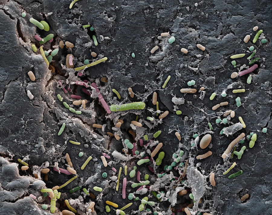 Colonoscopy Bacteria, Sem Photograph by Meckes/ottawa