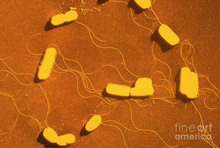 colony-of-listeria-monocytogenes-bacteria-photograph-by-a-dowsett