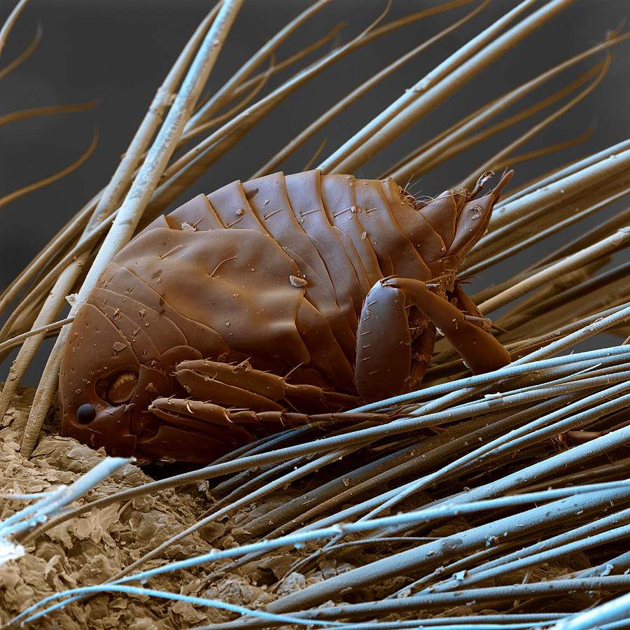 Male Sand Flea, SEM by Eye Of Science
