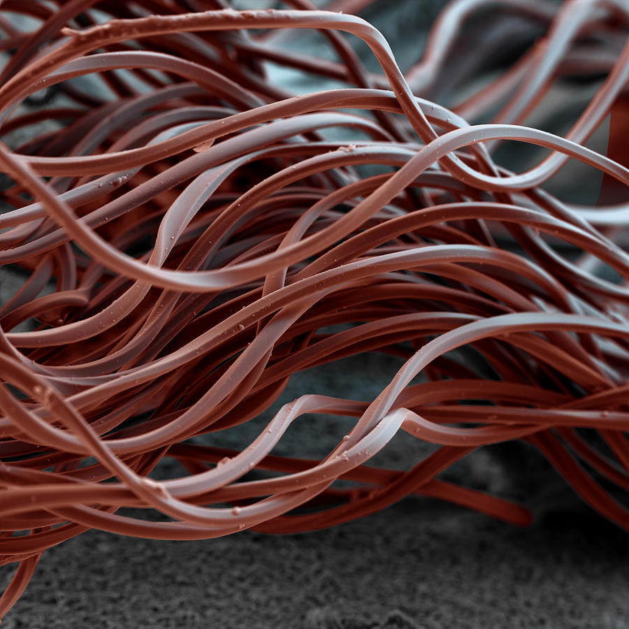 Colored Sem Of Polyester Fibers 150x Photograph by Meckes/ottawa