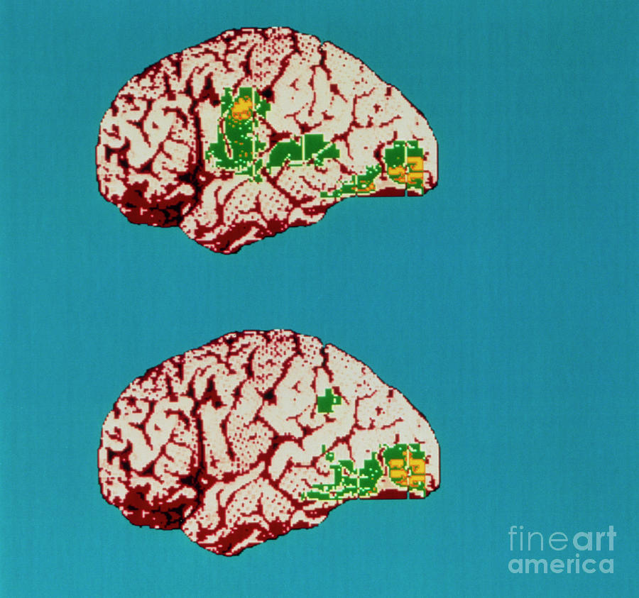 Colour Pet Brain Scan When Reading Aloud/silently Photograph by Wellcome Centre Human Neuroimaging/science Photo Library