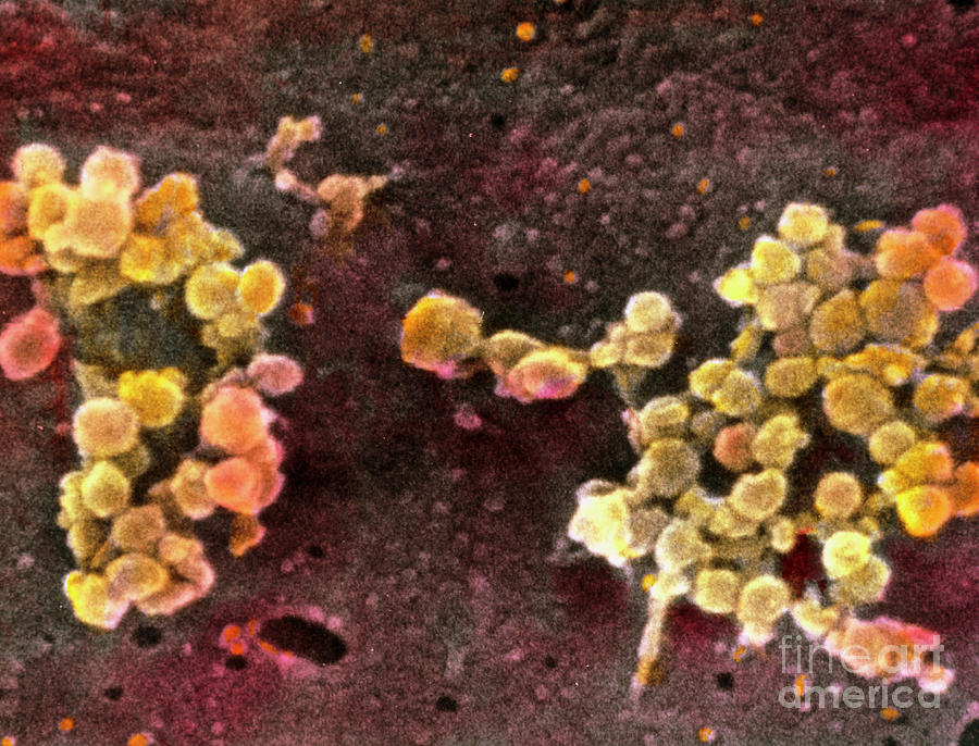 Colour Sem Of Synaptic Vesicles In Olfactory Cell Photograph by Professors P. Motta & T. Naguro/science Photo Library