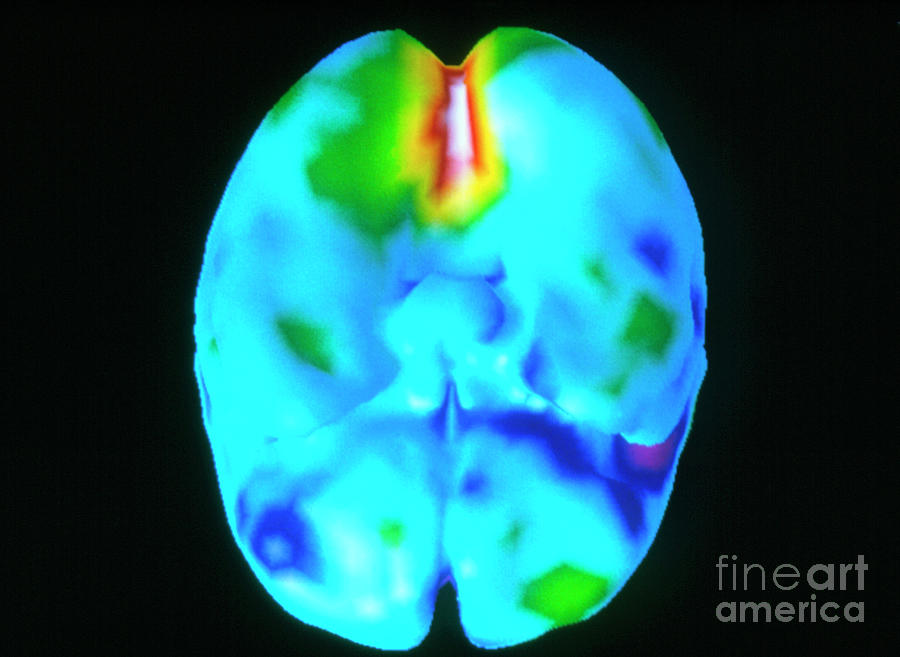 Coloured 3-d Pet Brain Scan During Visual Activity Photograph by Montreal Neurological Institute/science Photo Library