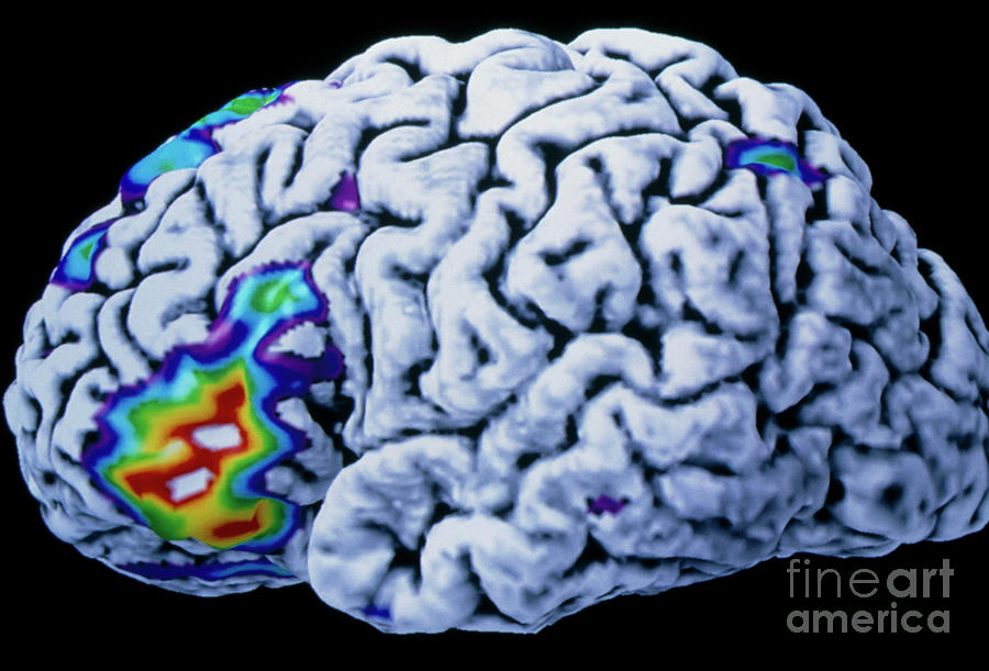 Coloured Pet Brain Scan During A Speech Exercise Photograph by Montreal Neurological Institute/science Photo Library