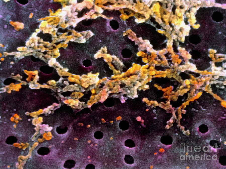 Coloured Sem Of Chromatin And Nuclear Pores Photograph by Professors P. Motta & T. Naguro/science Photo Library