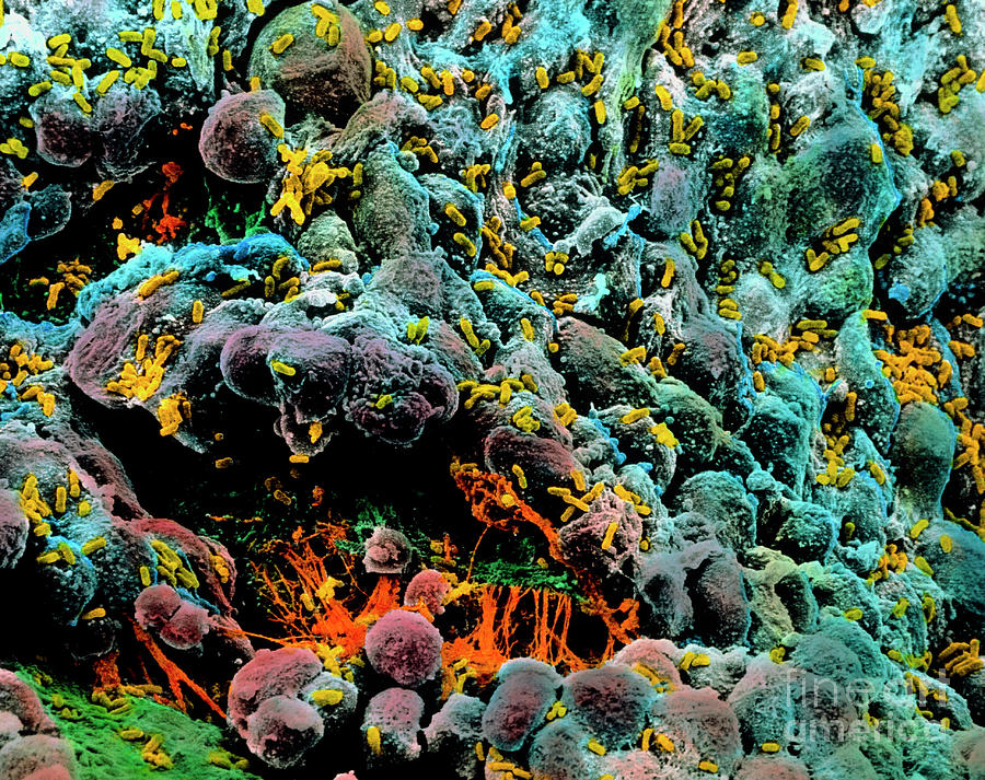 Coloured Sem Of E. Coli Infection Of The Bladder Photograph by