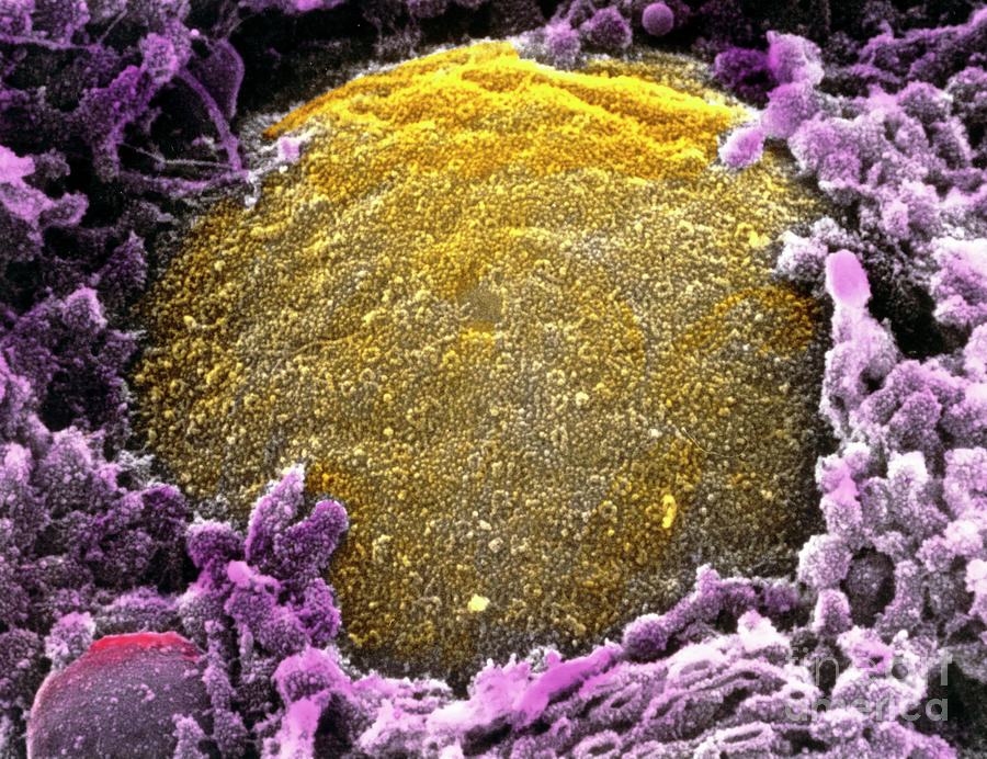 Coloured Sem Of Outer Surface Of Nuclear Membrane Photograph by Professors P. Motta & T. Naguro/science Photo Library