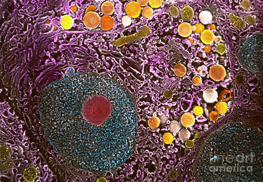 Coloured Sem Of Pancreatic Acinar Secretory Cell Photograph by Professors P. Motta & T. Naguro/science Photo Library