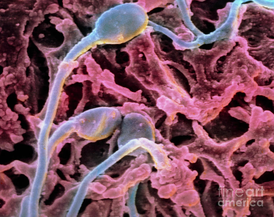 Coloured Sem Of Sperm On Egg During Fertilisation Photograph by Professor P.m. Motta Et Al/science Photo Library