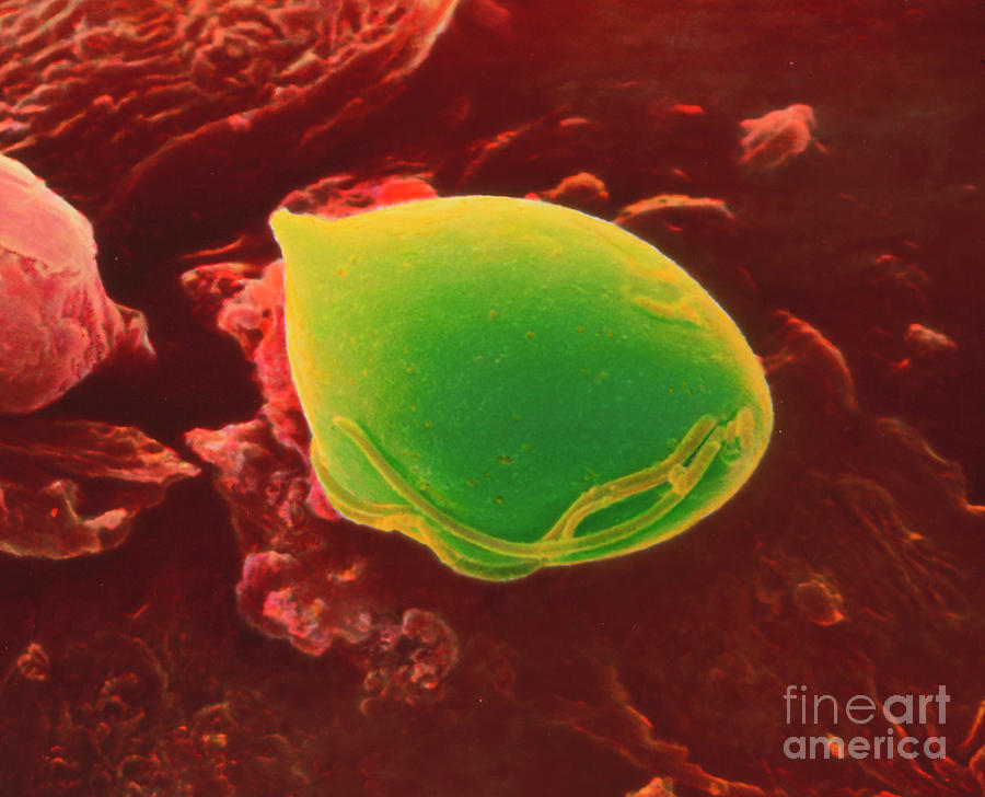 Wildlife Photograph - Coloured Sem Of Trichomonas Vaginalis by Moredun Animal Health Ltd/science Photo Library