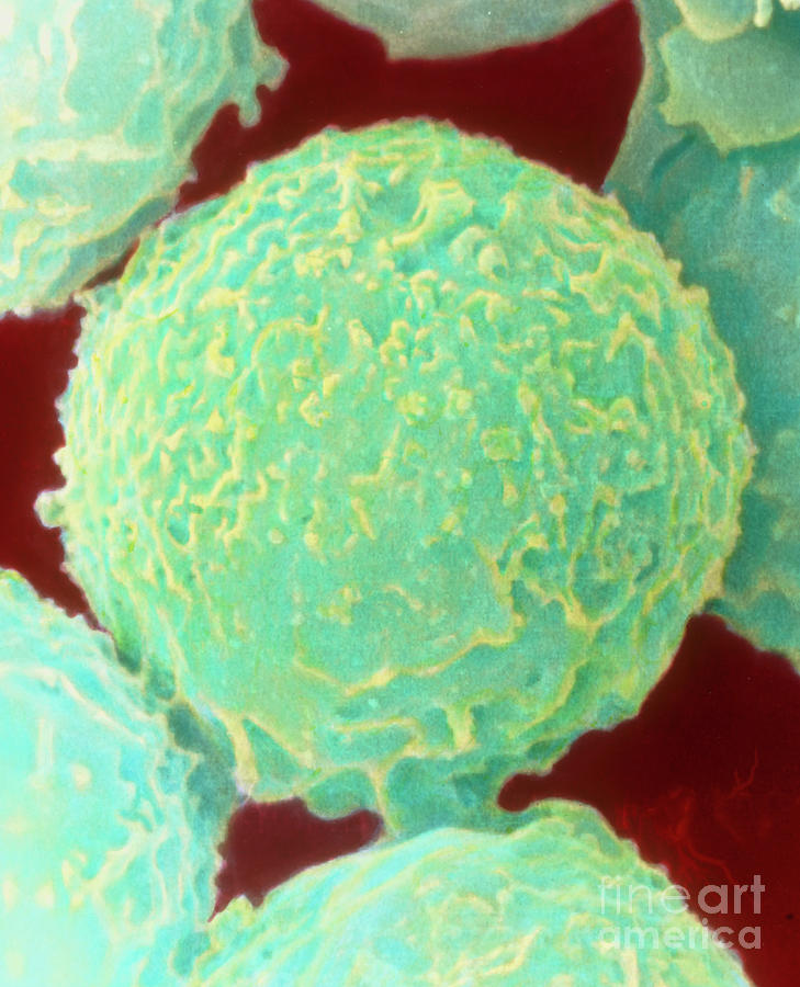 Coloured Sem Of White Blood Cells (neutrophils) Photograph by Dr Kari Lounatmaa/science Photo Library