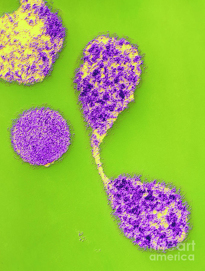 Coloured Tem Of Mycoplasma Pneumoniae Photograph By Dr Kari Lounatmaa