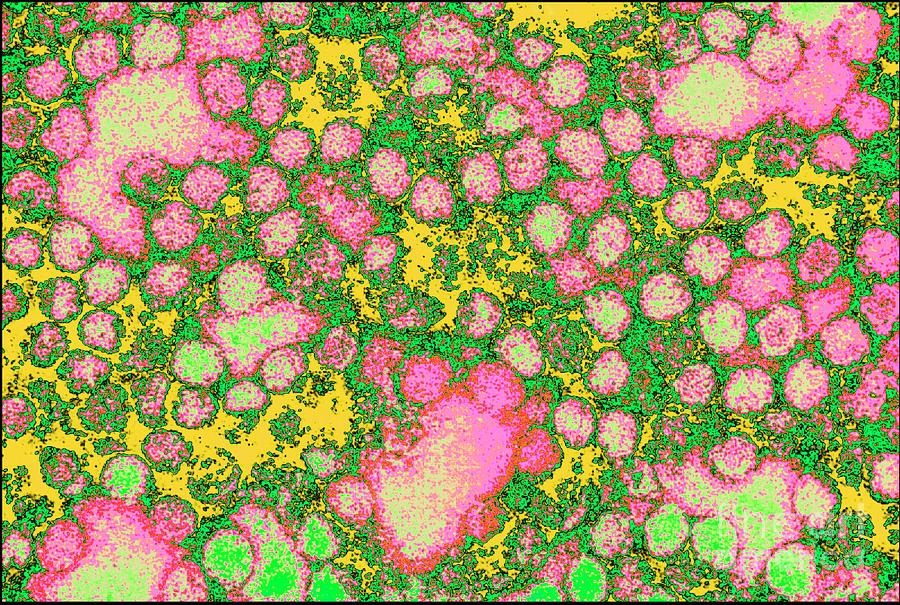 Coloured Tem Of Yellow Fever Viruses Photograph by Cdc/science Photo ...