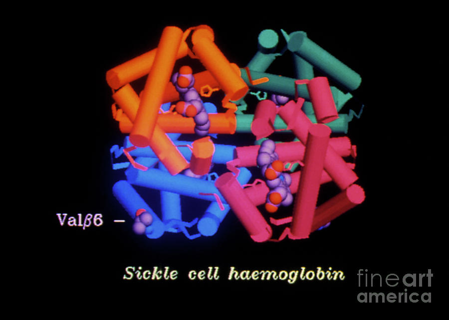 Computer Graphic Photograph - Computer Graphics Of Sickle Cell Haemoglobin by Professor Arthur Lesk/science Photo Library