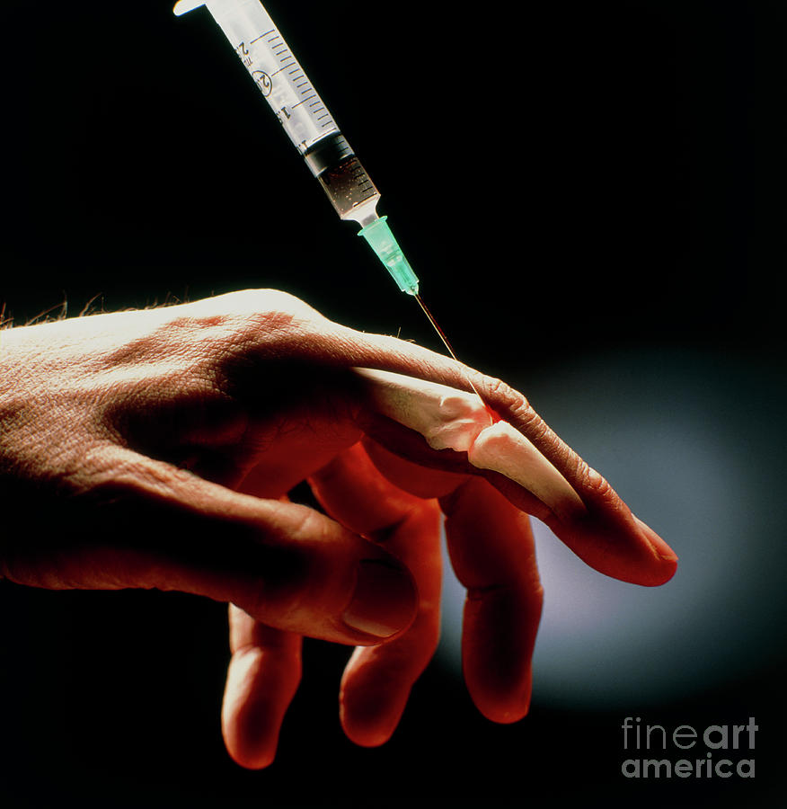 Conceptual Image Of An Injection Into Finger Joint by Oscar Burriel