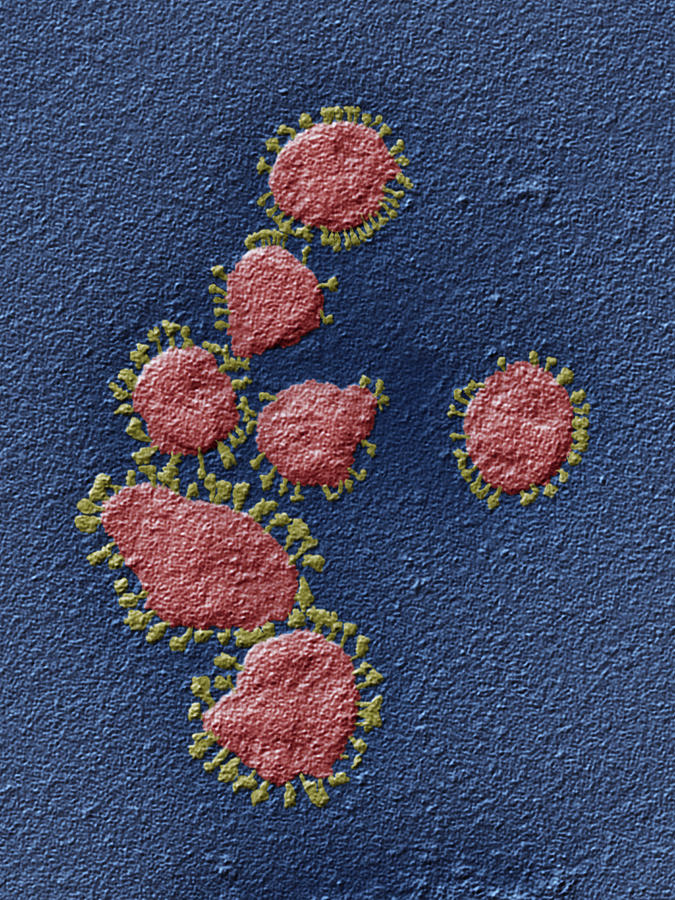 Coronavirus, Tem Photograph by Oliver Meckes EYE OF SCIENCE