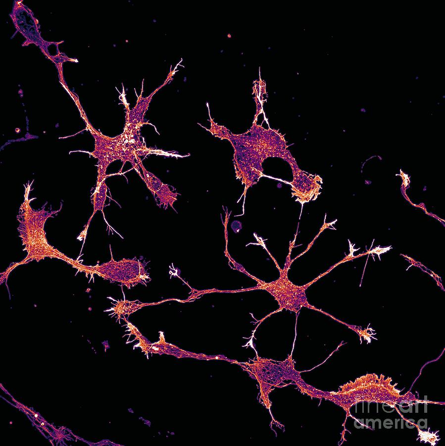 Cortical Neurons Showing Cytoskeleton Photograph by Howard Vindin, The University Of Sydney/science Photo Library