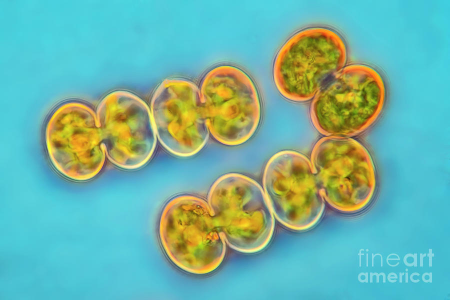 Cosmarium Contractum Var. Minutum Algae Photograph by Frank Fox/science Photo Library