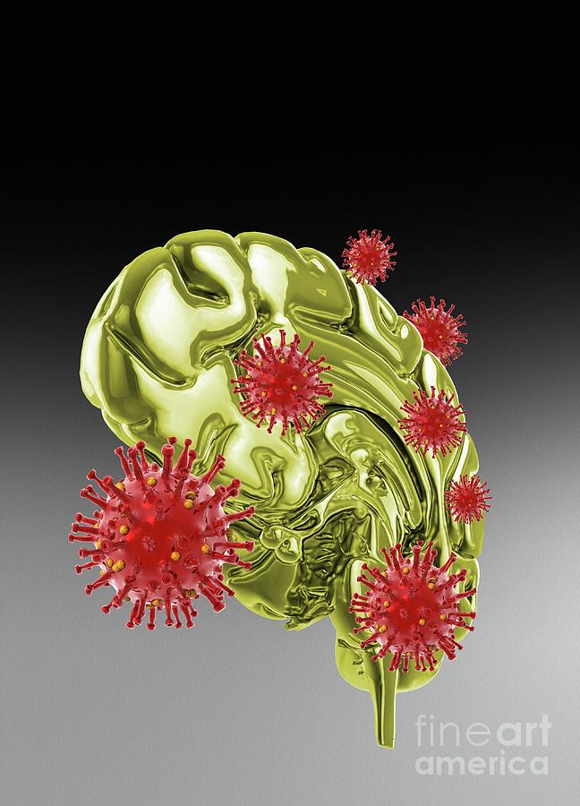 Covid-19 Virus Affecting The Brain Photograph By Victor Habbick Visions/science Photo Library ...