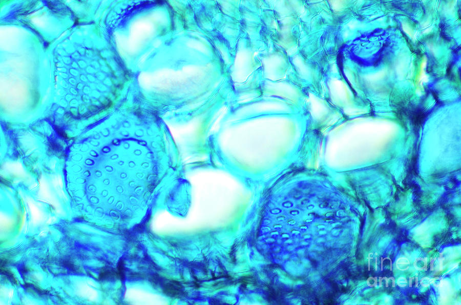 Cucumber Stem Tissue Photograph by Dr Keith Wheeler/science Photo Library