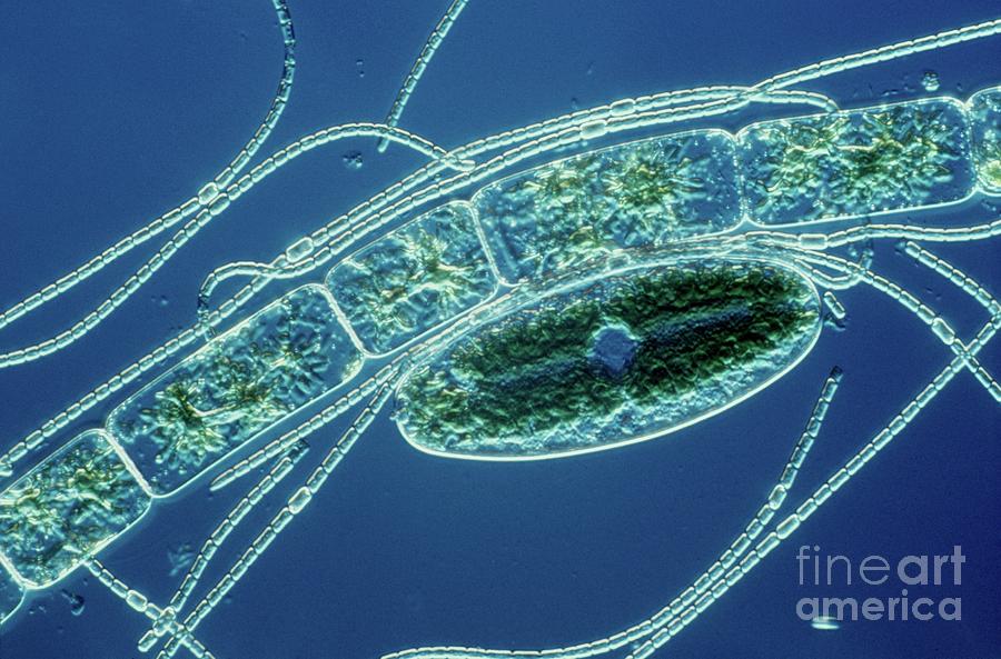 Cyanobacterium And Green Algae Photograph by Dennis Kunkel Microscopy/science Photo Library
