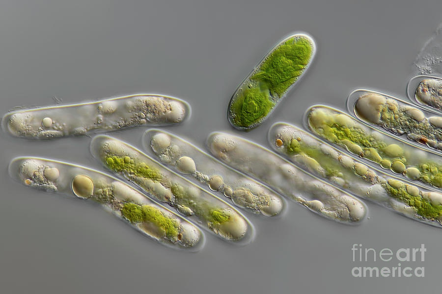 Cylindrocystis Brebissonii Algae Photograph by Frank Fox/science Photo Library