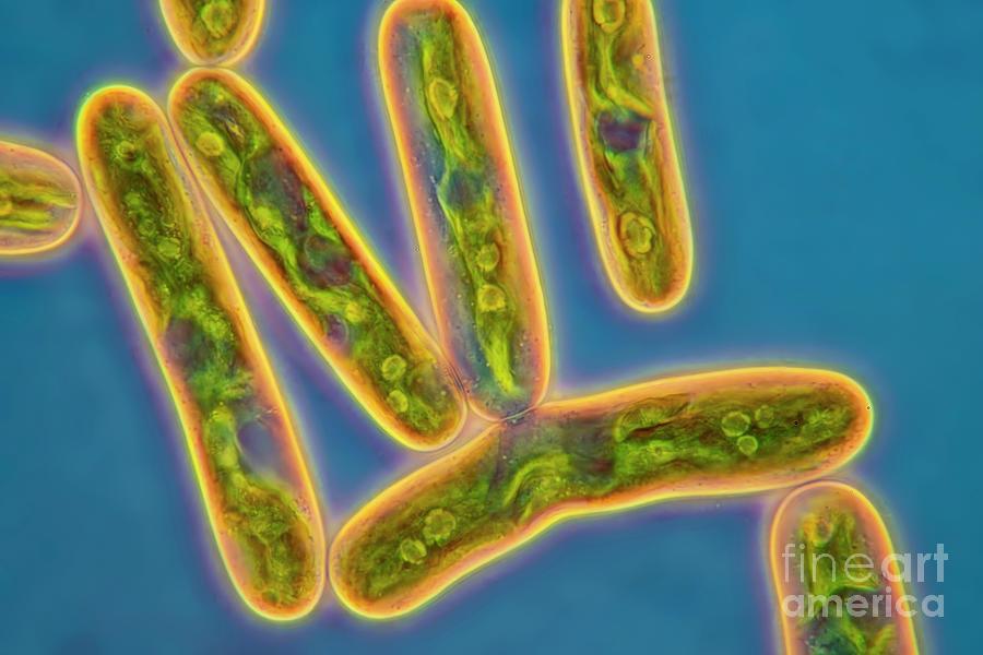Cylindrocystis Cushleckae Cf. Algae Photograph by Frank Fox/science Photo Library