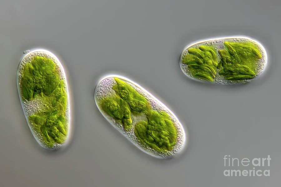Cylindrocystis Sp. Photograph by Frank Fox/science Photo Library