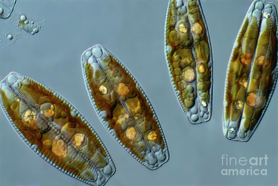 Cymbella Sp. Diatoms by Frank Fox/science Photo Library