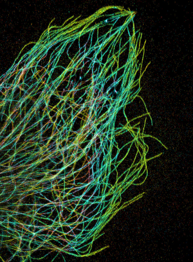 Cytoskeleton, Strands Of Tubulin Photograph by Science Source