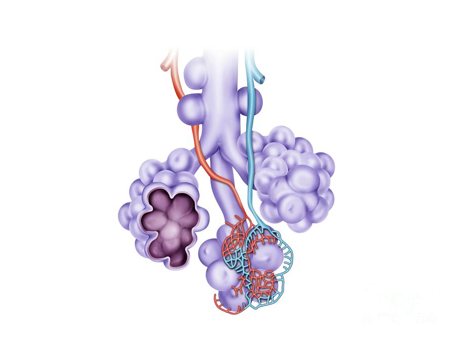 Damaged Alveoli In Lung Disease Photograph by Maurizio De Angelis ...