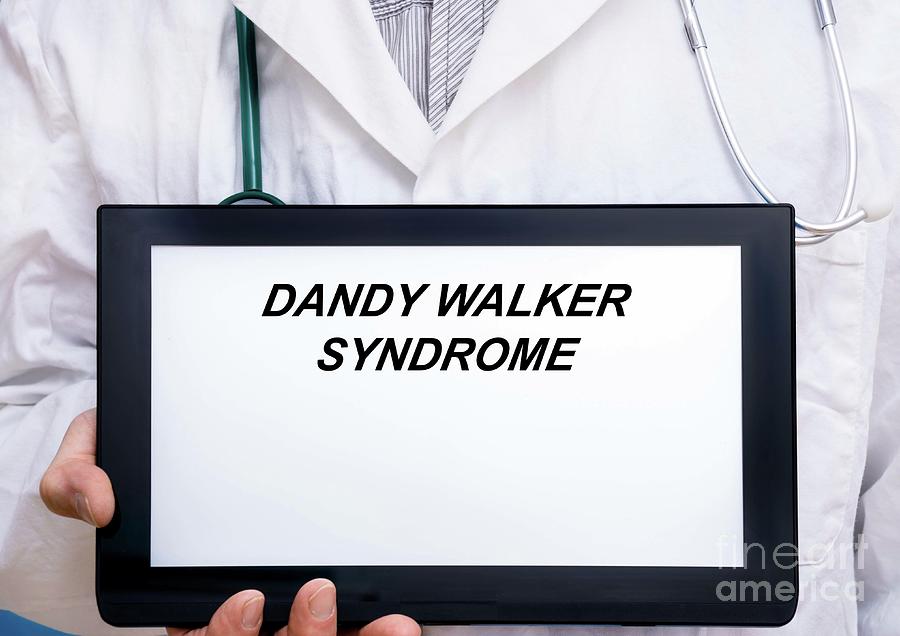 Dandy-walker Syndrome Photograph by Wladimir Bulgar/science Photo ...