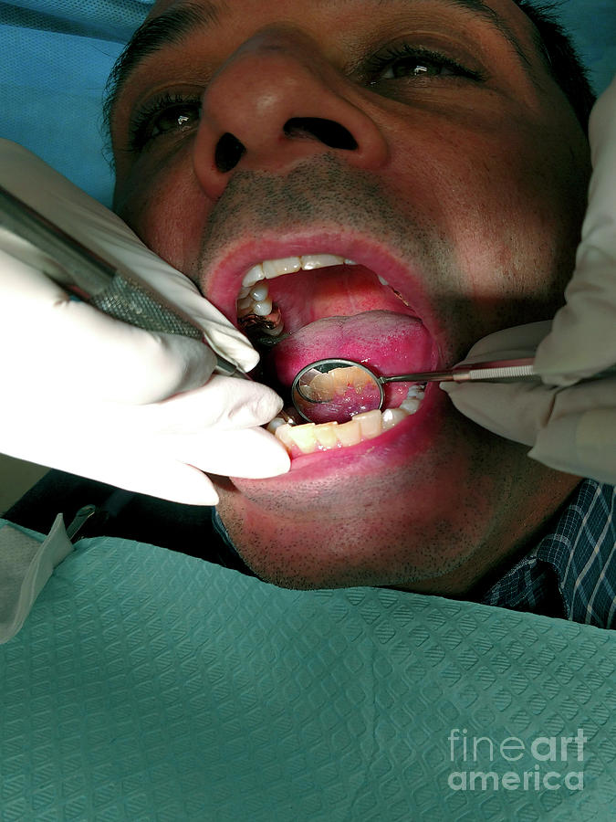 Dental Cleaning - Tooth Checkup  Photograph by David Oppenheimer