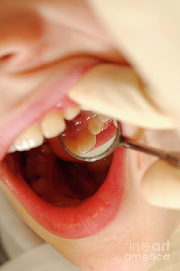 Dental Examination Photograph by Medicimage / Science Photo Library
