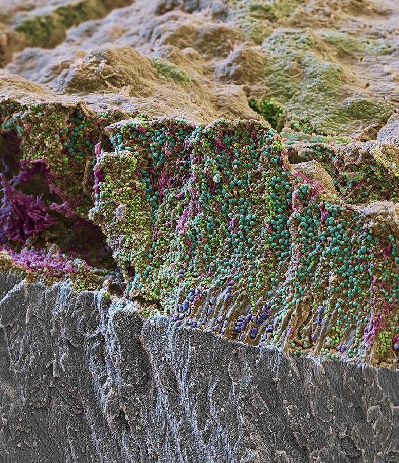 Dental Plaque, Sem Photograph by Oliver Meckes EYE OF SCIENCE