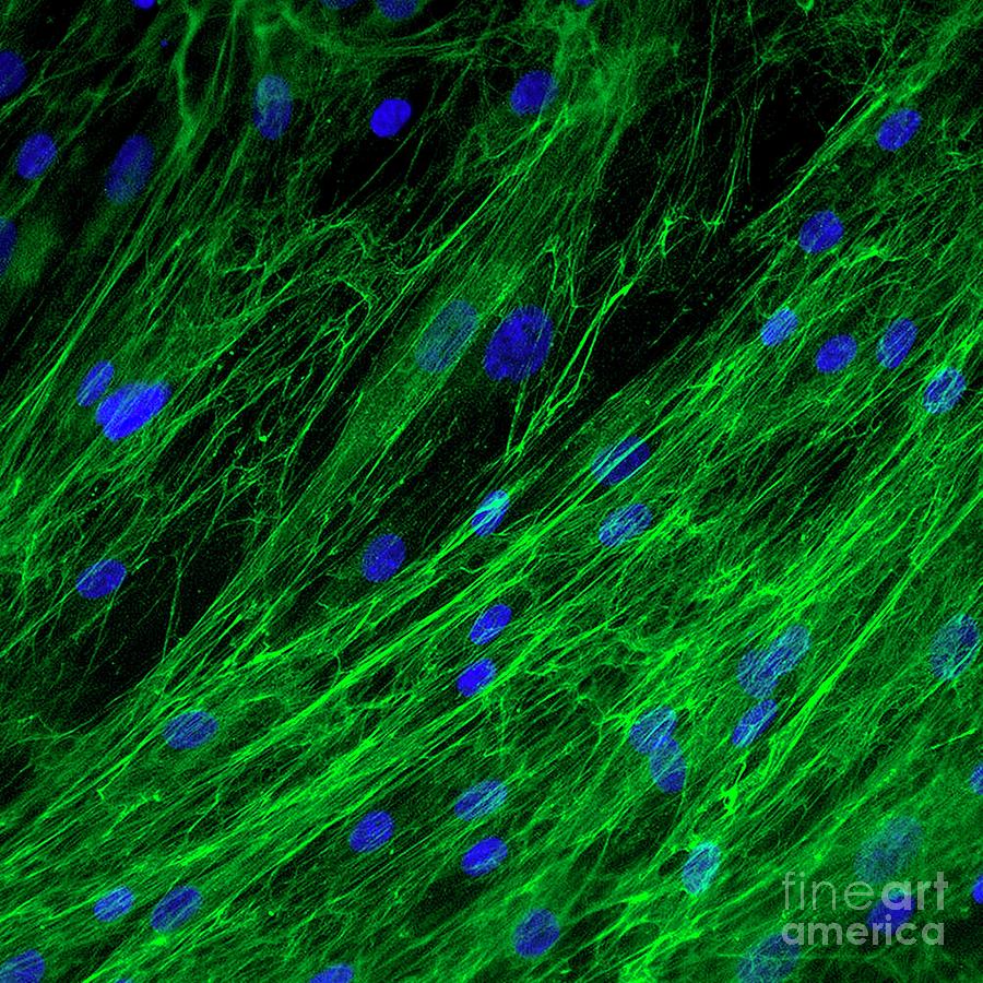 Dermal Fibroblast Cells Photograph by Daniel Schroen, Cell Applications Inc/science Photo Library