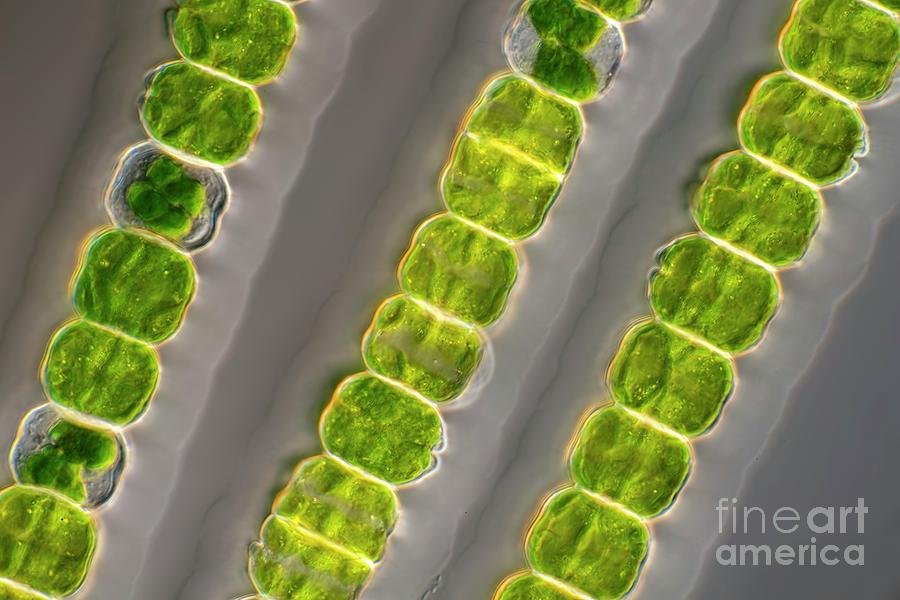 Desmidium Coarctatum Green Algae Photograph by Frank Fox/science Photo ...