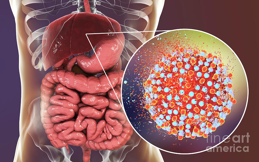 Destruction Of Hepatitis C Viruses Photograph by Kateryna Kon/science ...