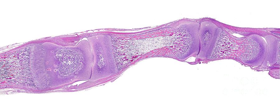 Developing Bone Joints Photograph by Jose Calvo / Science Photo Library