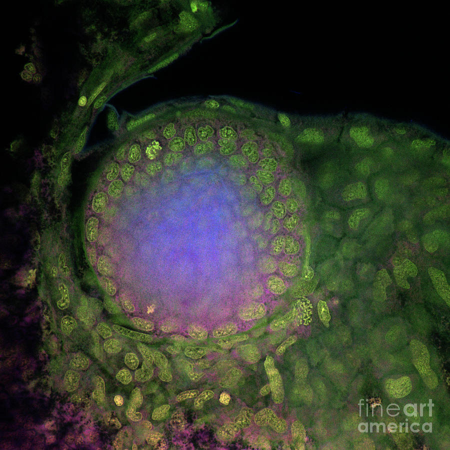 Developing Eye Photograph by Stefanie Reichelt/science Photo Library
