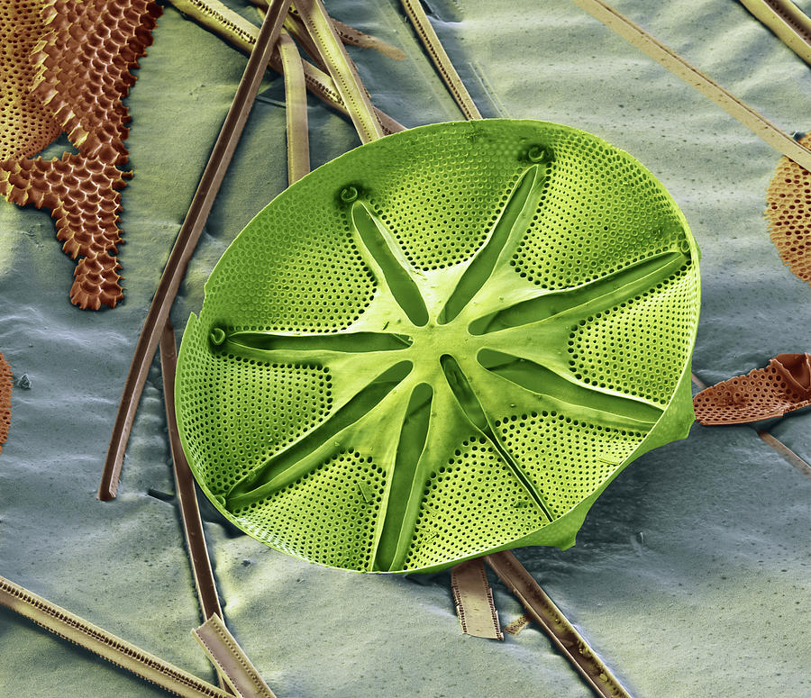 Diatom Asteromphalus Sp., Sem Photograph by Oliver Meckes EYE OF SCIENCE