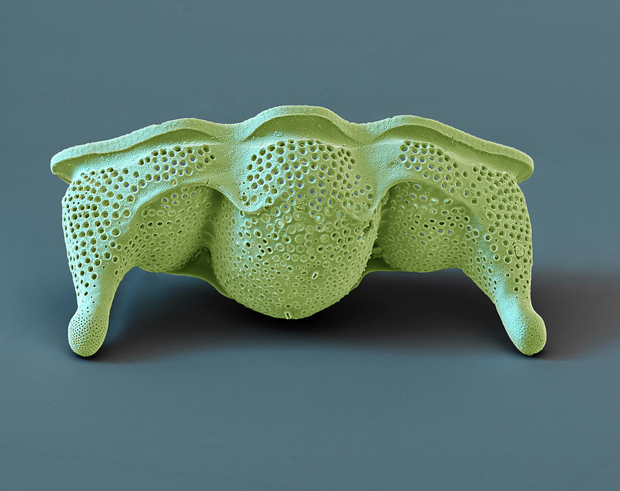 Diatom Hemiaulus Polymorphus, Sem Photograph by Oliver Meckes EYE OF SCIENCE